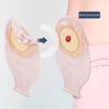 10Pcs Barrier Stoma Ostomy Strips Tape Strip Rings Adhesive Pressure Fixing Colostomy Leak Proof Colostomy Bag Barrier Strip
