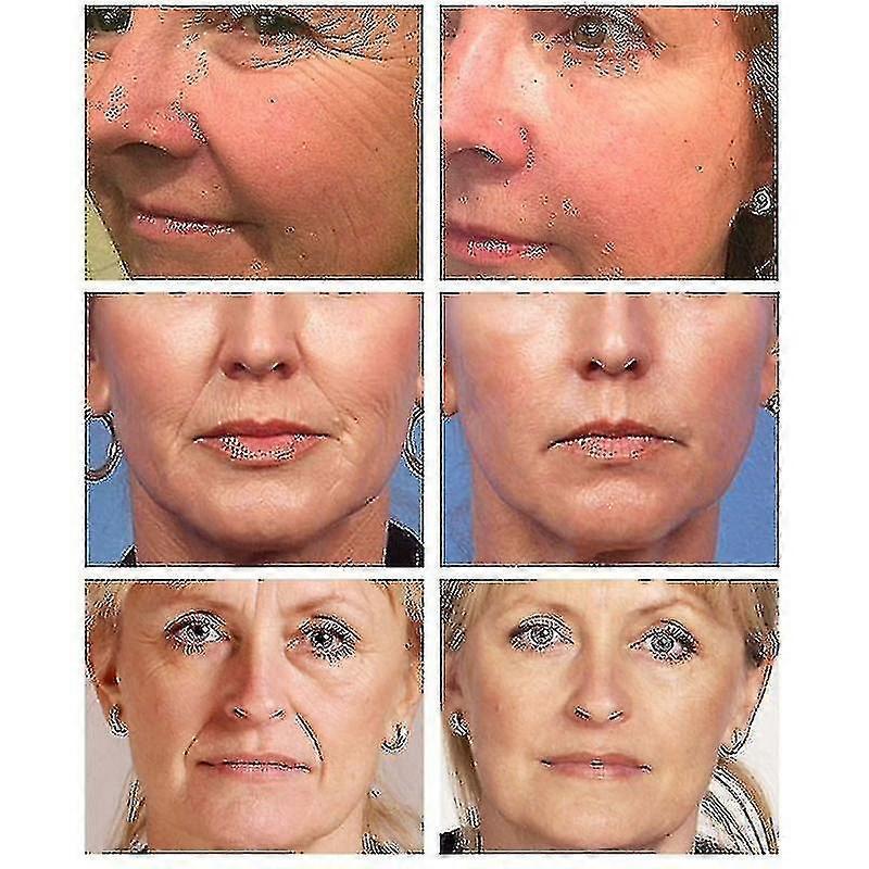 Retinol Wrinkle Removal Face Cream Firming Lift Anti-aging Eye Fade Fine Lines B