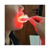 Vindecare Afte Bucale Ameliorator Gingivită Terapie Lumină Roșie LED Dispozitiv Terapeutic