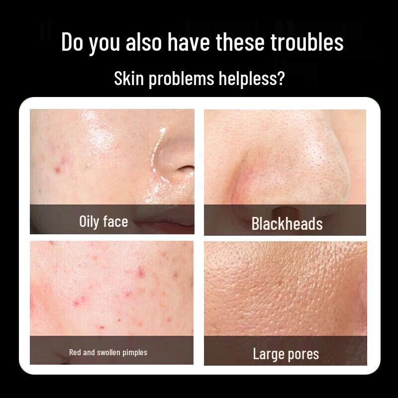 Bai Cuilai Facial Cleansers & Treatments