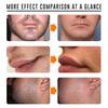 Men Hair Removal Cream Beard Remover Cream Moisturizing Beard Depilatory Cream