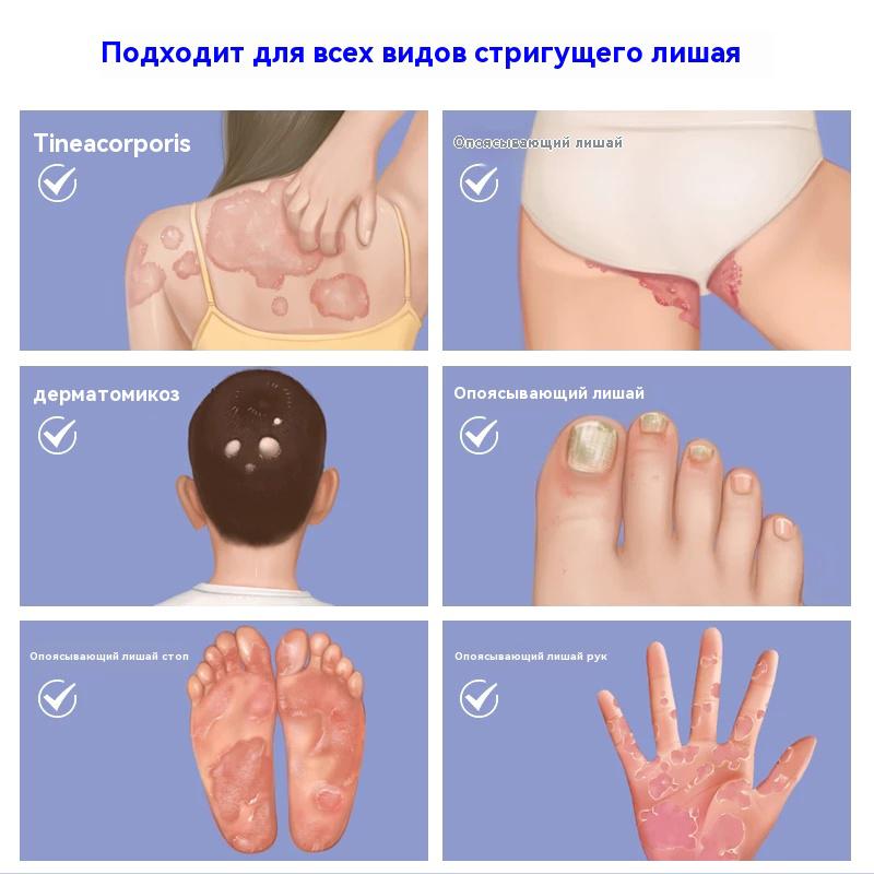 Caoshifu Natural Herbs Creams for Itch Solve Skin Problems 15g