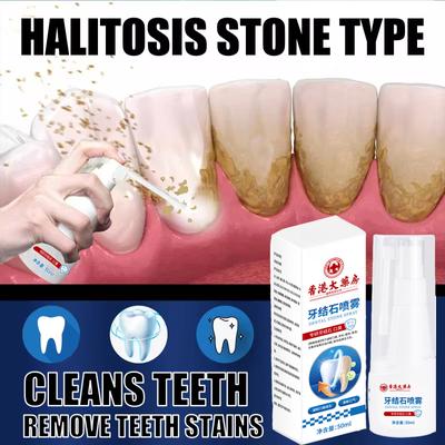 Dental Calculus Remover Teeth Whitening Spray Toothpaste Cleaning Oral Hygiene Removal Halitosis Plaque Stains Fresh Breath Care 1/2/3 PCS