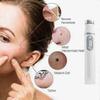 Laser Pen for Spider Vein Removal and Wrinkle Treatment
