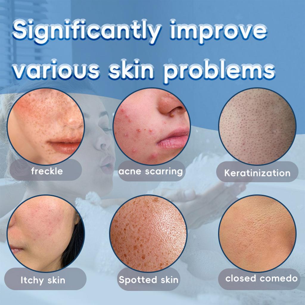 Kojic Brightening Soap Cleanses Pores, Reduces Wrinkles, Brightens The Skin And Deeply Nourishes The Skin