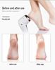 Electric Callus Remover Foot File: Rechargeable Pedicure Tool and Best Seller.
