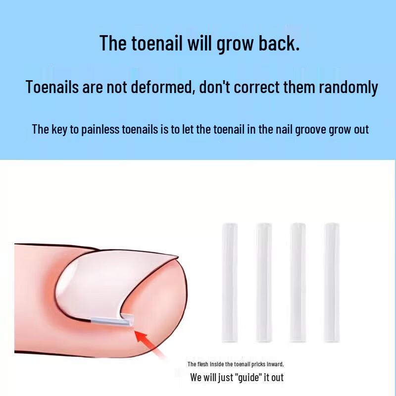 Ingrown Toenail Correction & Repair Kit