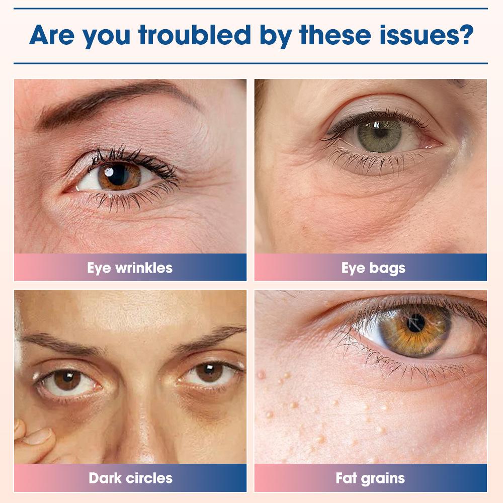 Eye Massager Red Light Hot Compress EMS Microcurrent Eye Instrument Lightens Dark Circles and Relieves Eye Fatigue