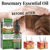 2pcs Rosemary Oil For Hair Growth,rosemary Essential Oil For Hair Growth Skin Care,improve Hair Loss And Nourishes