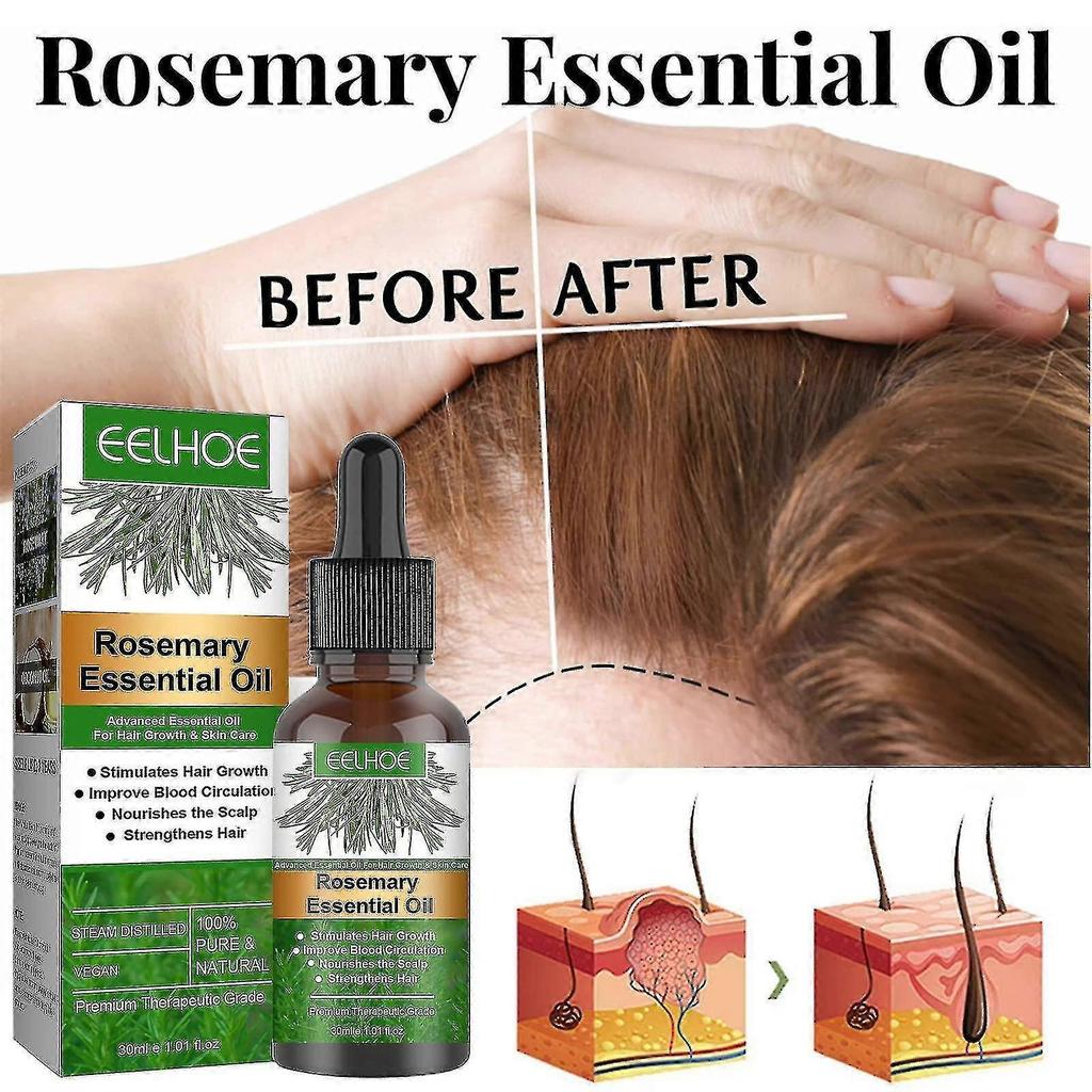 2pcs Rosemary Oil For Hair Growth,rosemary Essential Oil For Hair Growth Skin Care,improve Hair Loss And Nourishes