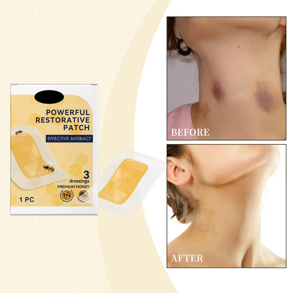Náplast s medem pro péči o pleť, hojivá a regenerační náplast, pomáhá účinně a pohodlně hojit rány.