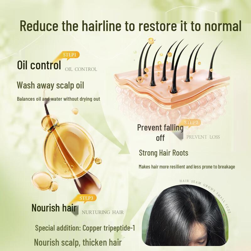 Anti-Dandruff Oil Control Anti-Hair Loss Shampoo