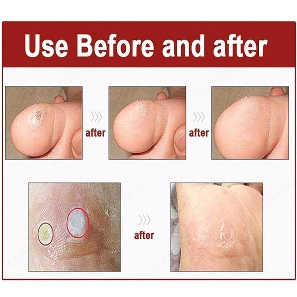 60pcs Toe And Foot Protectors Pads Corns Callus Feet Sore Shoes Sticker Self Adhesive Cushions Soft Heel Pad Foam Foot Paste