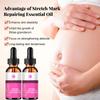 5ML/15ML/30ML/50ML/Mild Without Irritation Stretch Mark Spray Repair Removal Acne Scar Stretch Marks Cream Fat Scar Striae Gravidarum