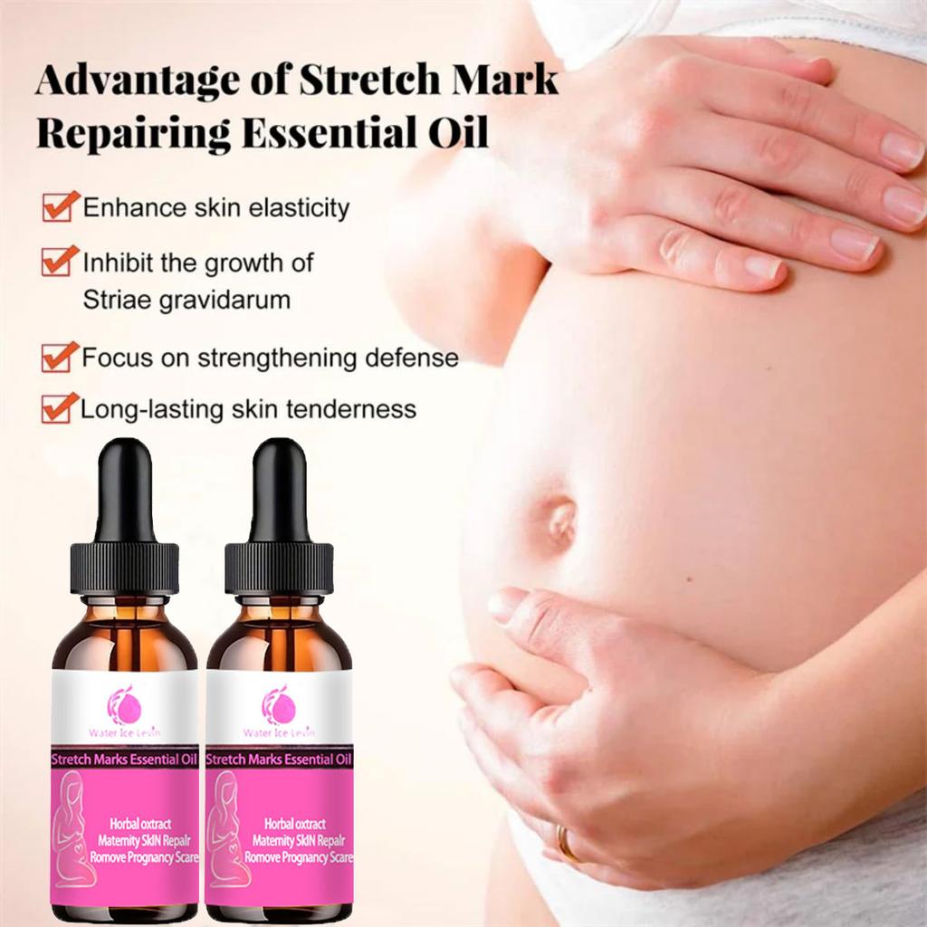 5ML/15ML/30ML/50ML/Mild Without Irritation Stretch Mark Spray Repair Removal Acne Scar Stretch Marks Cream Fat Scar Striae Gravidarum