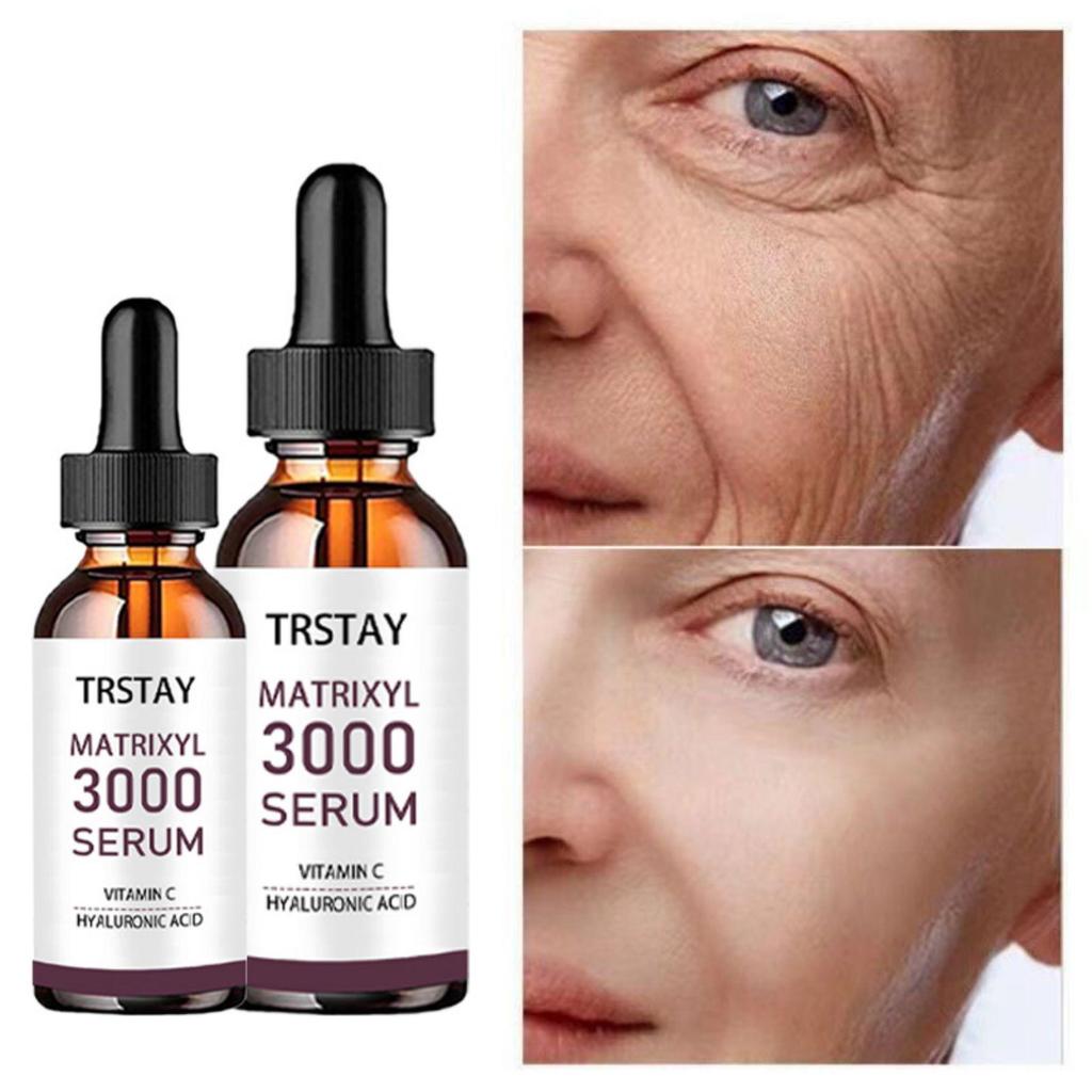 5ML/15ML/30ML/50ML/TRSTAY Ultimate Wrinkle-Reducing Face Serum for Radiant Skin