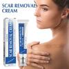 Jaysuing Scar Cream Advanced Formula For Smoothing And Tightening Skin With Post-surgery Scar Treatment For Flawless Results In 30g Packaging