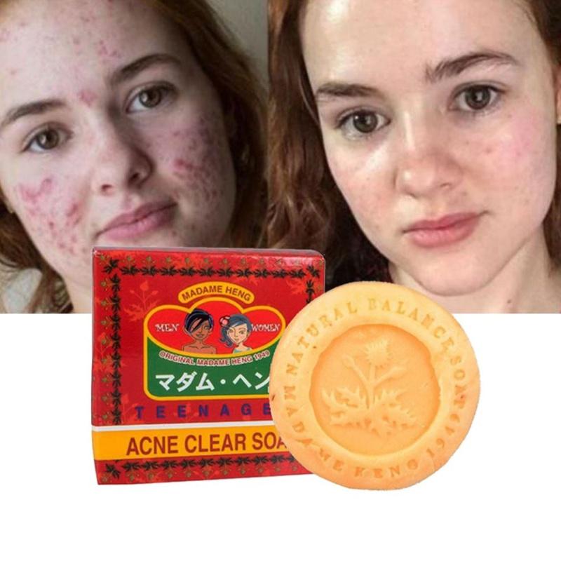 Madame Heng Spezialseife gegen Akne, klar, 150 g, für Teenager, Männer und Frauen – hergestellt in Thailand