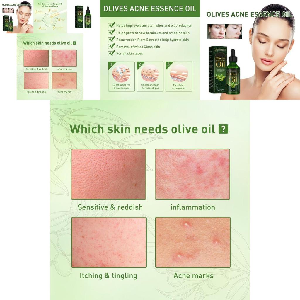 Jaysuing Essential Oil For Gentle Moisturizing And Acne Scar Repair 30ml