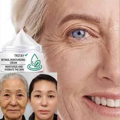 Active Retinol Cream Reduces Wrinkles for Younger Looking Skin