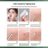 Stainless Steel Blackhead Needle & Tweezer Set for Pimples & Closed Comedones - Complete Acne Tool Kit
