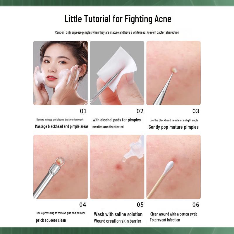 Stainless Steel Blackhead Needle & Tweezer Set for Pimples & Closed Comedones - Complete Acne Tool Kit