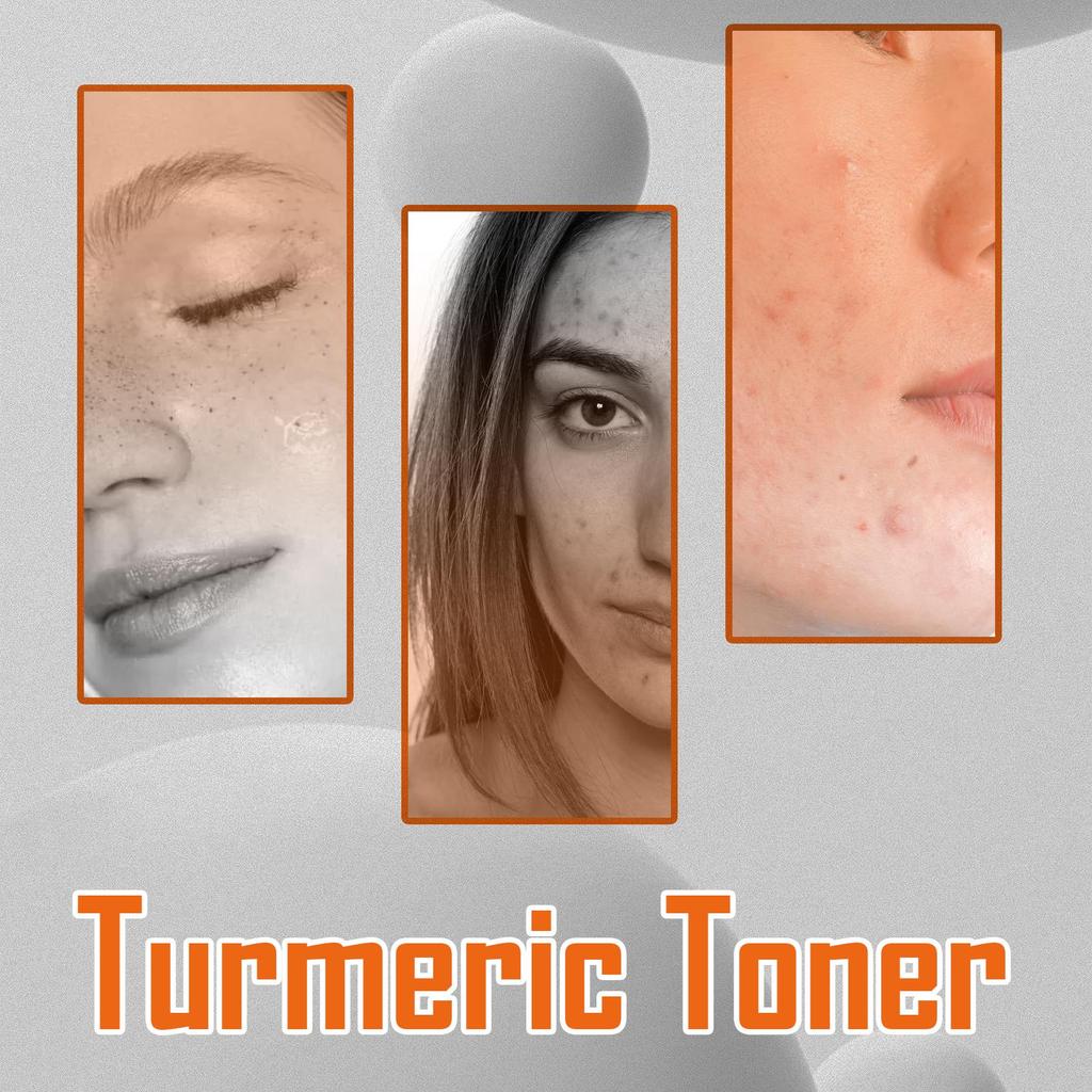 West&Month Anti-Dark Turmeric Toner ,Deeply Hydrates and Moisturizes, Brightens and Firms Facial Skin, Suitable for Face 100ml