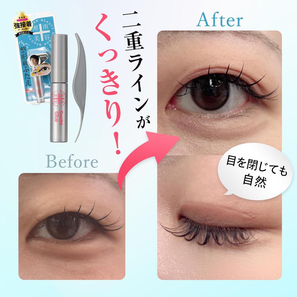 Shonan Beauty Clinic Eyelid Glue Double Eyelid Glue 4g Shonan Beauty unique strong - - Clinic's adhesive, long-lasting hold.