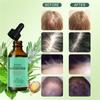 Mint Scalp & Hair Strengthening Oil For All Hair Types W/Biotin 60ml