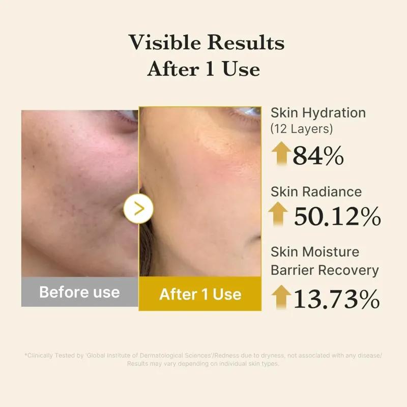 [MEDICUBE] Kojic Acid Termeric Vita Jelly Mist Serum 100ml