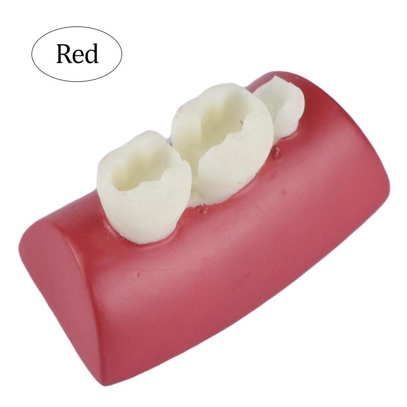Dental Inlay Practice Model Block Made of Resin for Filling Exercises Typodont Training and Student Dentistry Education