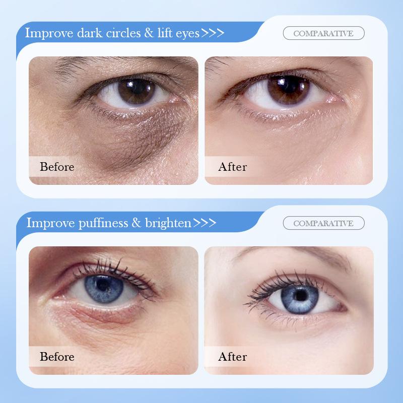 SADOER 8D Kyselina hyaluronová Krém na oči proti vráskám a zpevňující - Hloubkově hydratační a vyživující