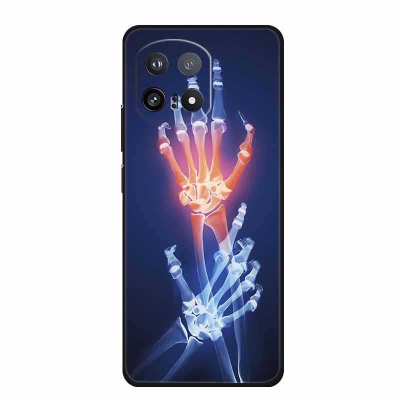 Phone Case For Vivo iQOO 15 5G Case I2501 Coque Black Silicone Soft TPU Back Cover For Vivo iQOO 15 2025 Cases Protective Shells