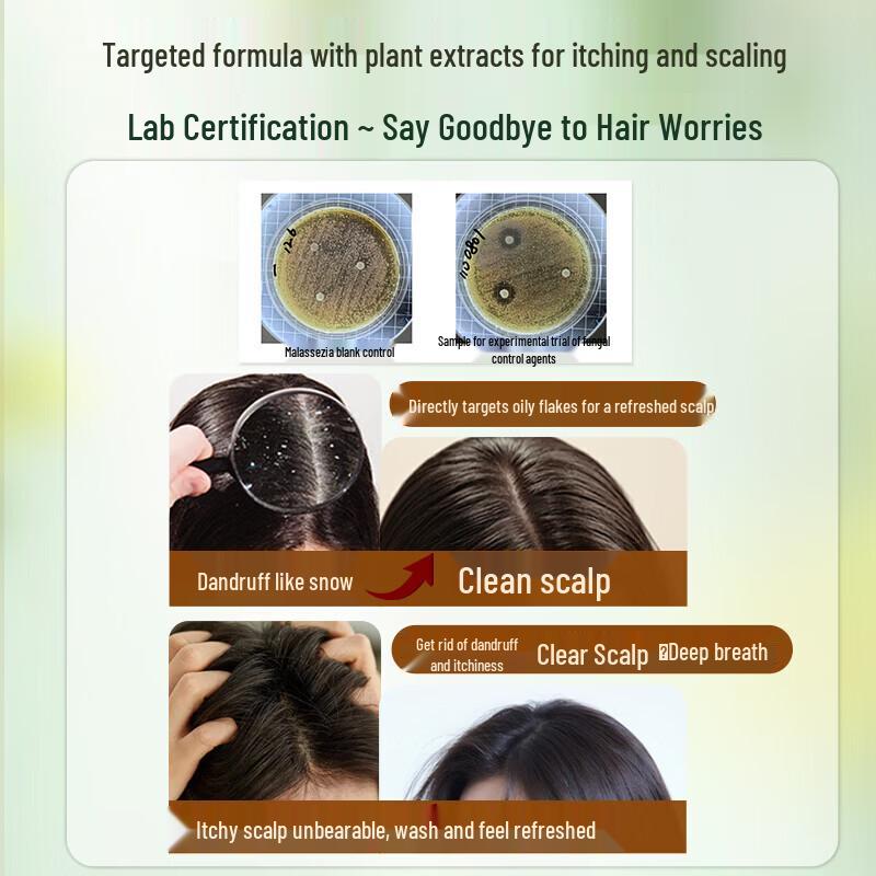 BAWANG Anti-Dandruff and Anti-Itch Shampoo
