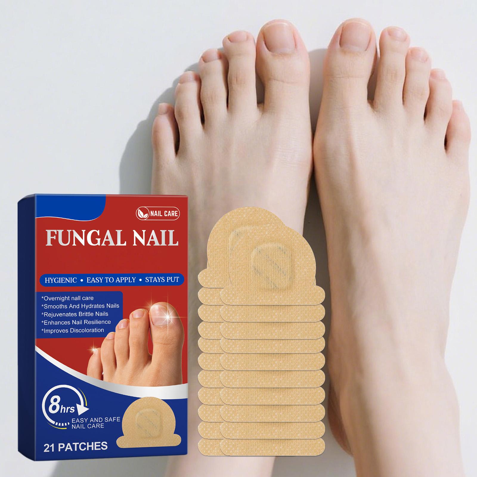 

Fungal Nail Hands And Feet Soft Nail Inlaid Nail Thickening Bright Nail Furrow Gray Nail Care Patch 21pcs One Size червоний