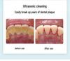 Nettoyeur de dents à ultrasons: Éliminateur de tartre, de taches et de plaque dentaire à trois vitesses pour le blanchiment des dents
