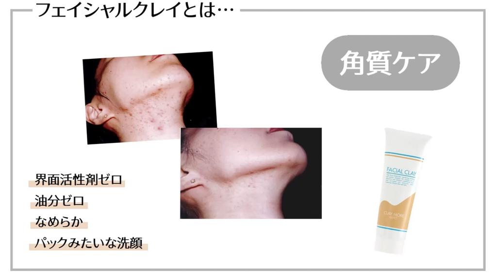 Claymore Kate Facial Clay Clay Facial Cleanser Clay Facial Cleanser Clay Facial Pack Facial Cleanser Clay (280g)