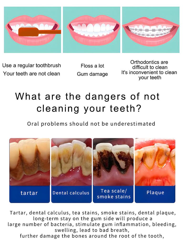 Portable Ultrasonic Water Flosser: Electric Teeth Cleaner & Oral Descaling Device