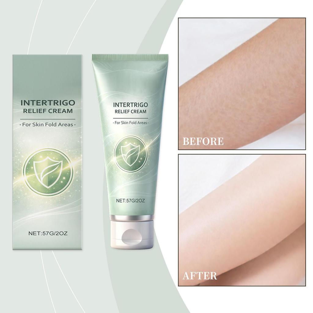 Hautfaltencreme 57g Beruhigende Nichtfettende Lotion Achselhöhlencreme für Damen Herren Reibungsreduzierung Feuchtigkeitsschutz Achselhöhle