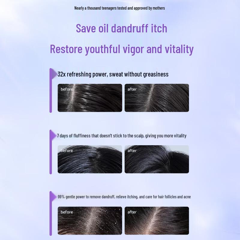 Fanyongchen Teenager & Student Anti-Dandruff Oil Control Volumizing Shampoo