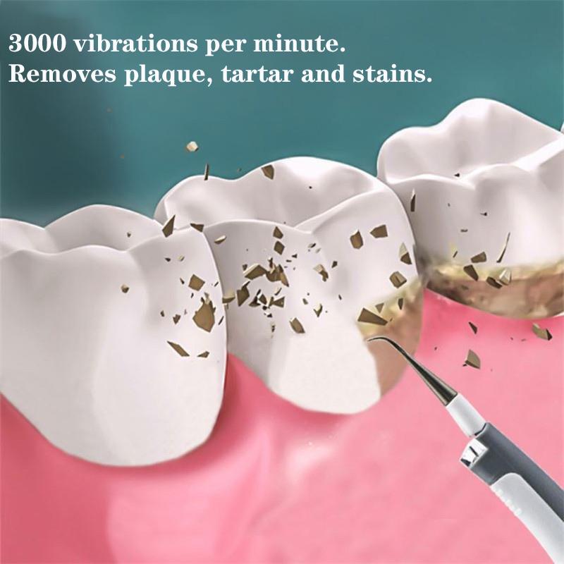 Přenosný elektrický ultrazvukový sonický pic zubní odstraňovač zubního kamene čistič zubních skvrn nástroj na zubní kámen odstraňování zubního kamene