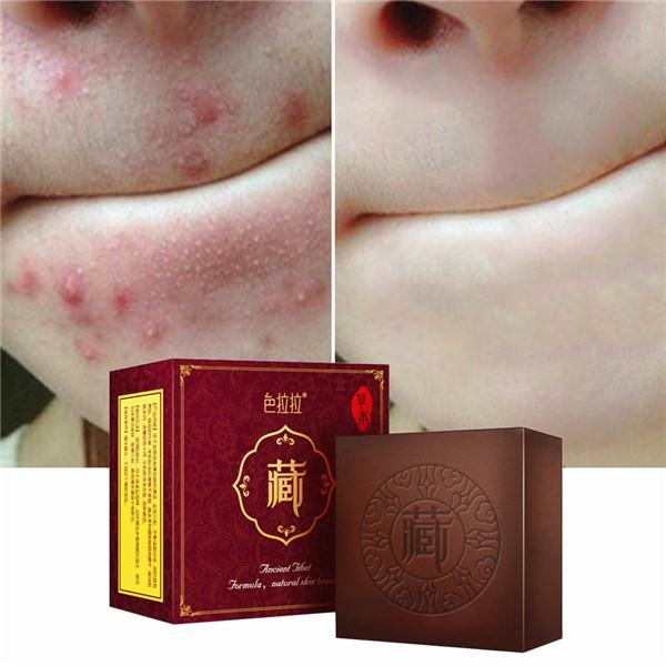 dg body acne control cleanser