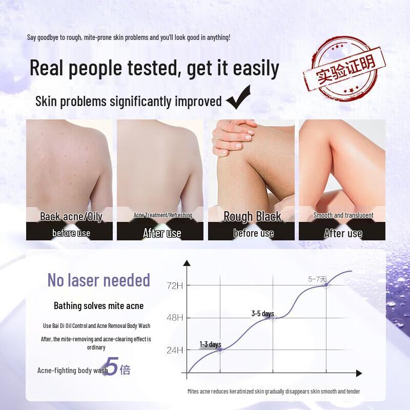 Baitei Oil Control & Acne-Fighting Amino Acid Shower Gel