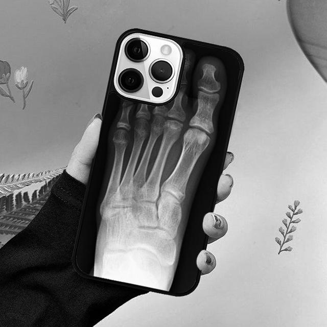 Röntgenaufnahme Menschliche Anatomie Handyhülle Für iPhone 17 Air 15 16 16e 11 12 13 14 Pro Max Hülle Für iPhone 17 Air Max Plus coque Fundas