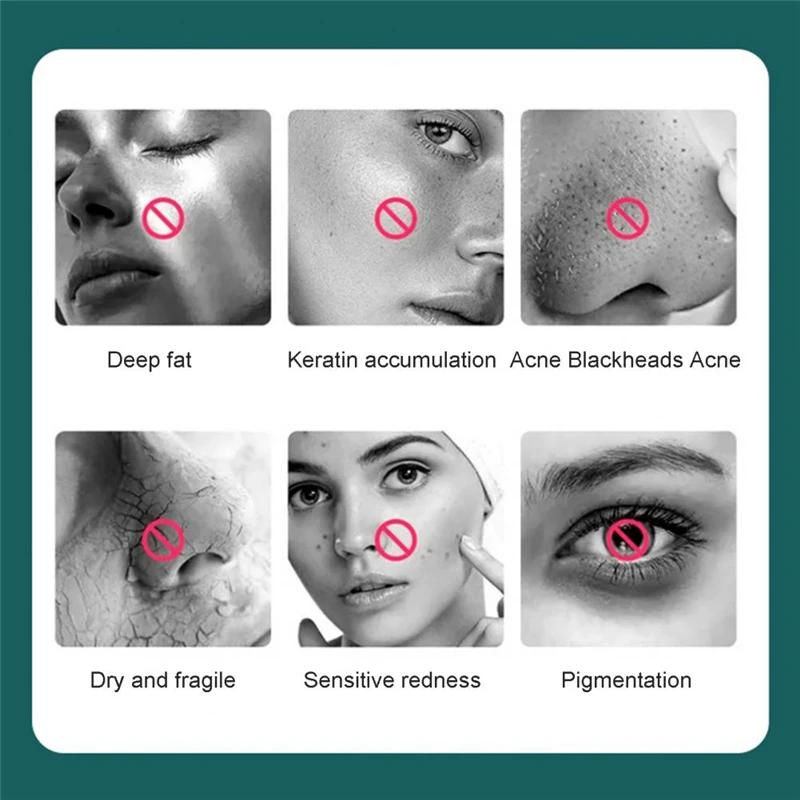 Elektrický čisticí silikonový kartáč na obličej Kočičí tlapka Vibrační masážní prostředek na odstranění černých teček Makeup Clean Face Wash Nástroj pro péči o pleť