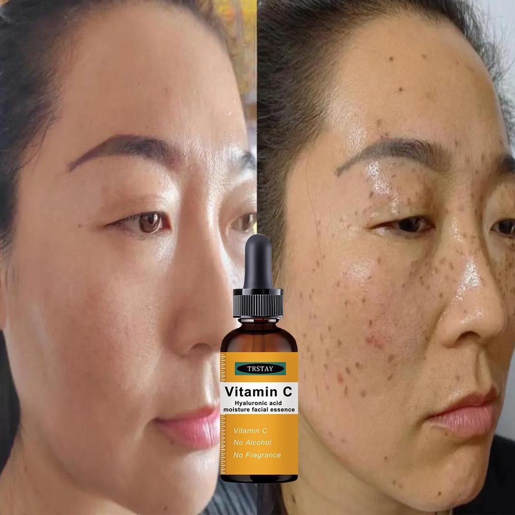 Dark Spot Repair Cream Age Spots Sun Spots Chloasma Arbutin Anti-aging Brightening Skin Whitening Cream