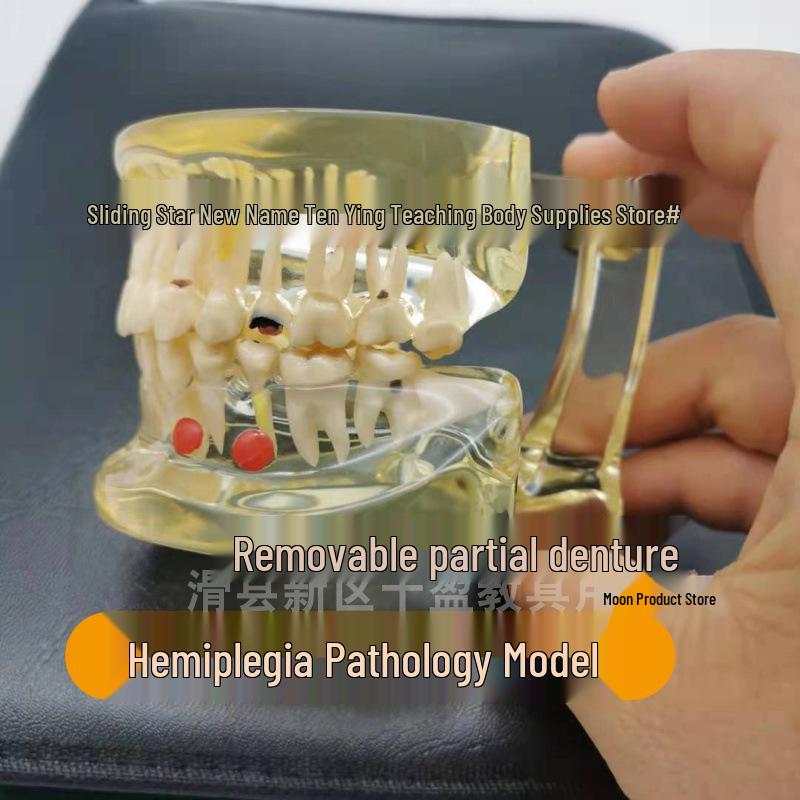 Detachable Dental Pathology Model for Adult Oral Teaching with Caries and Tooth Decay Visualization