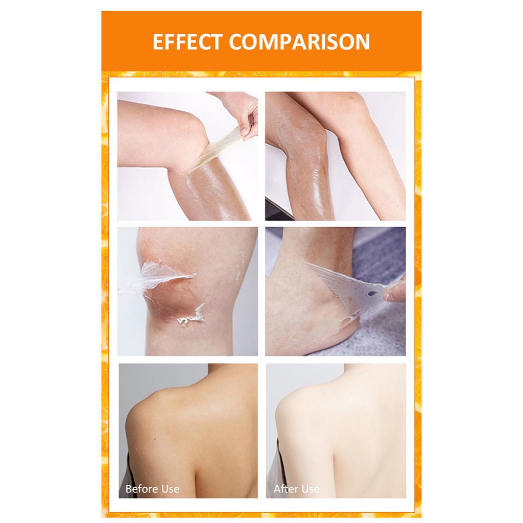 MOOYAM 100ml Orange Peeling Lotion Peeling Oil Body Lotion Gentle Exfoliating Gel Remove Dead Skin