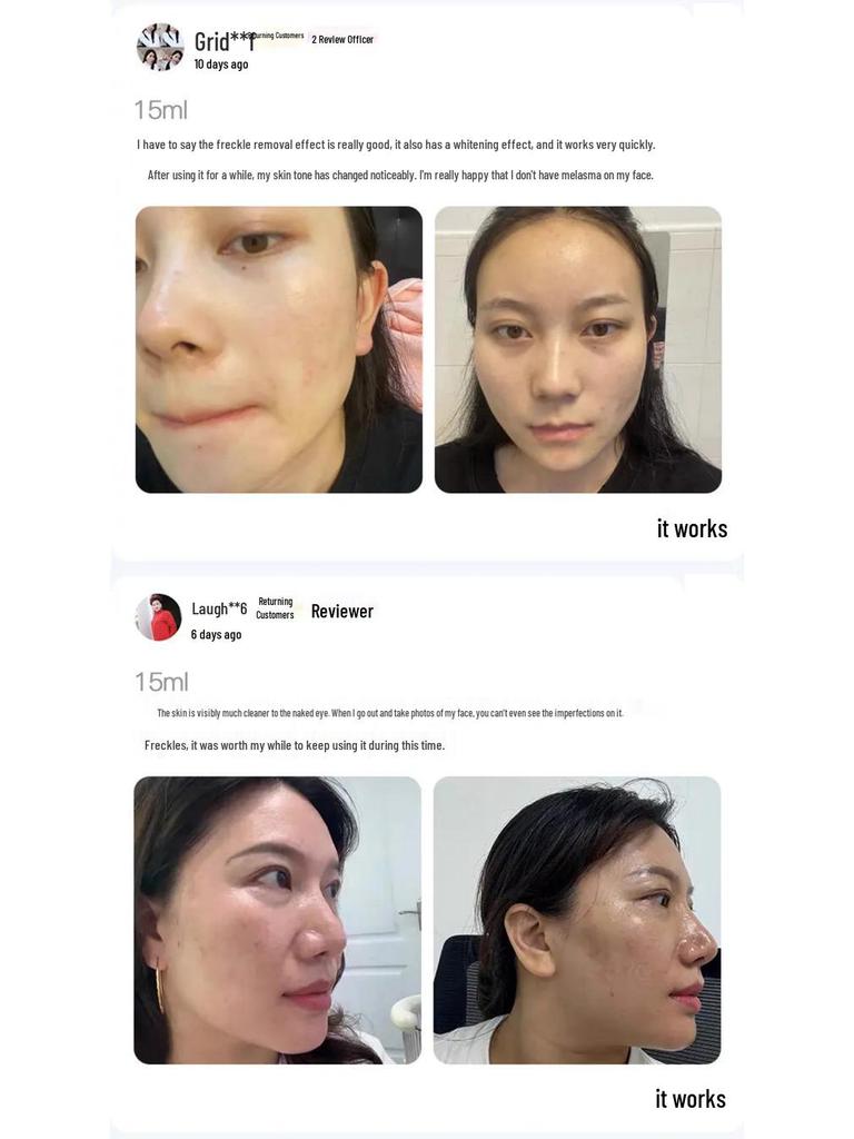 Han Bei Dan White Oil - Whitening & Freckle Removal Essence