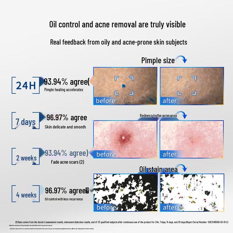 Fu'erjia Clear Acne Purifying Essence Ampoules